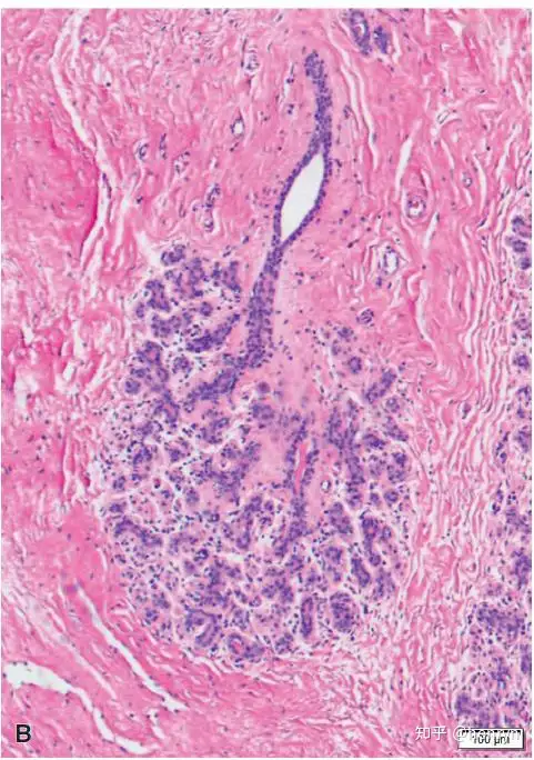 涧腺陵菇蹦优氧裕理澜违(图2)