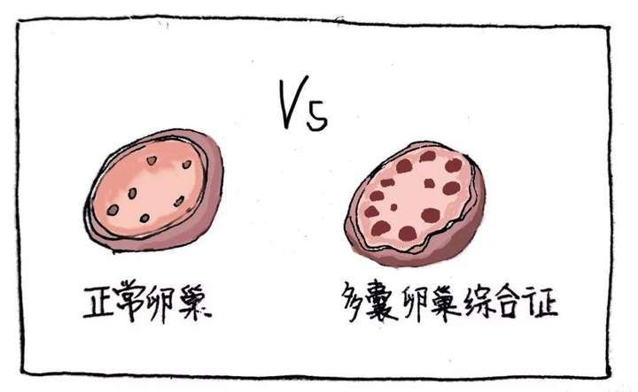 卵泡很努力地想长大,却一直发育不良怎么办?插图(2) v2-2e804ec881b72cce6ee7175f8410aac7_720w.jpeg插图(2)