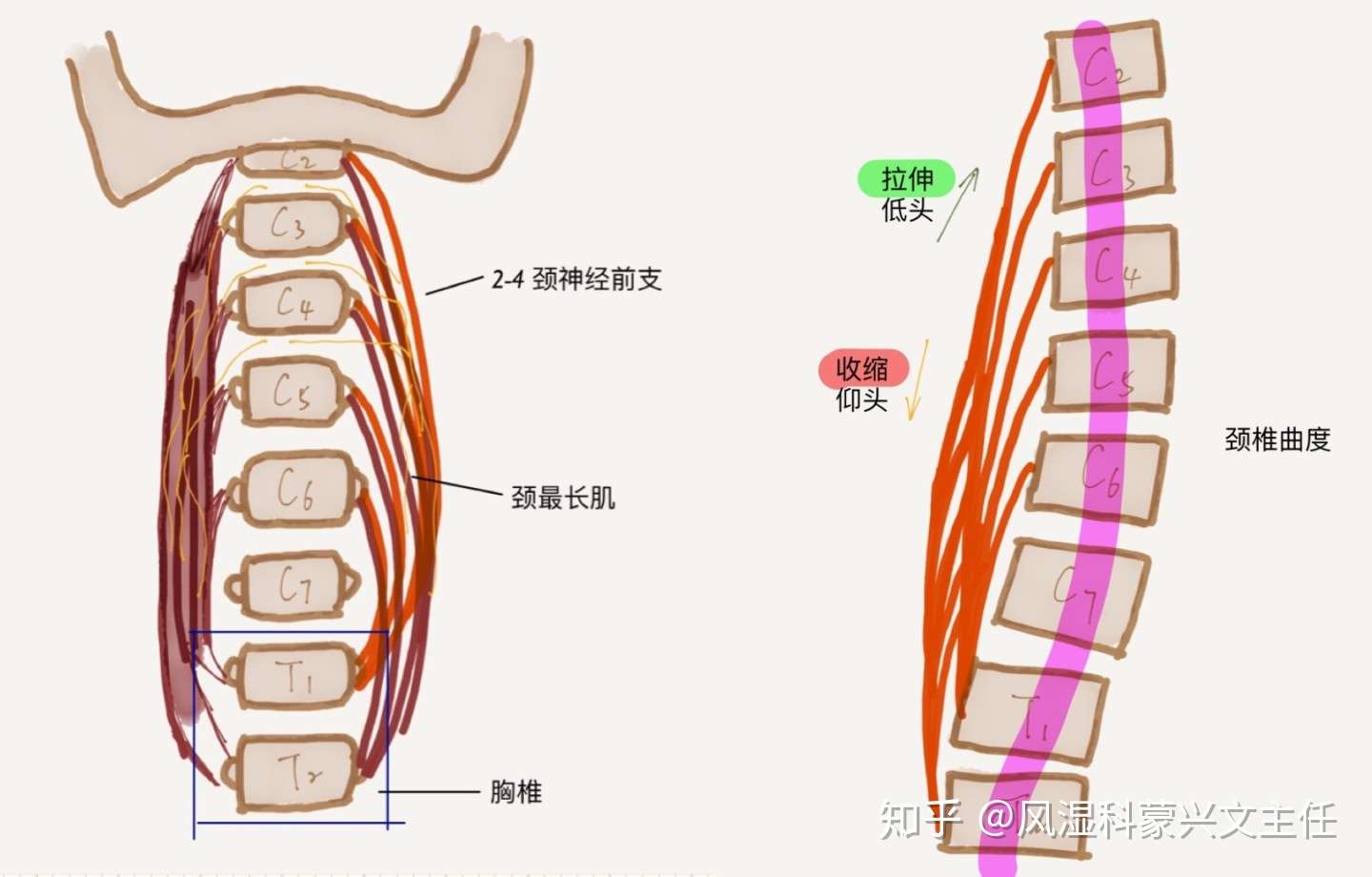 颈椎病自测方法 自己可以这样查 知乎