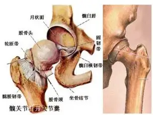 奇穴排瘀调理股骨头坏死的经验分享
