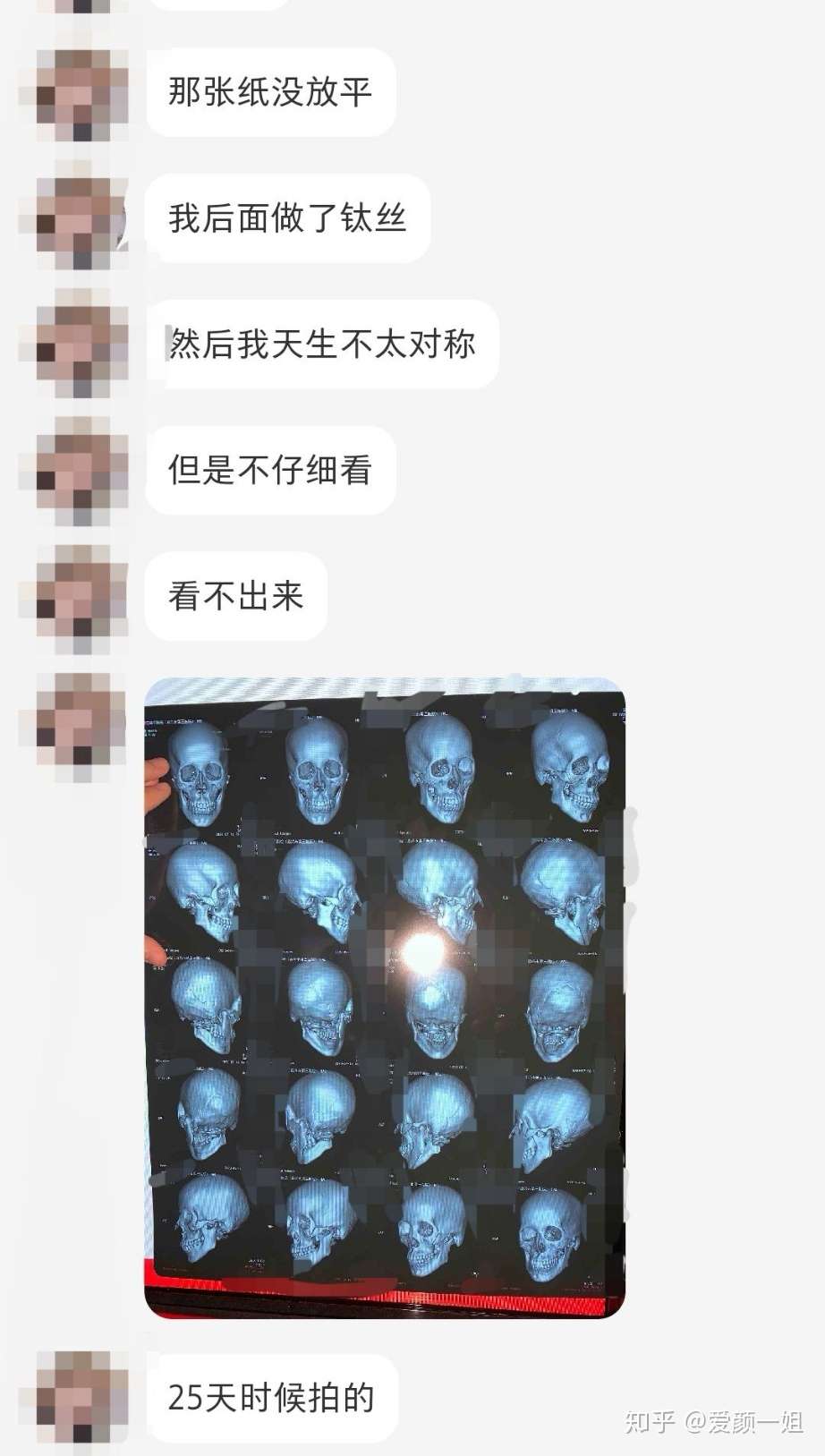 之前一直说骨缝问题 很多姐妹还是忽略了一点 知乎