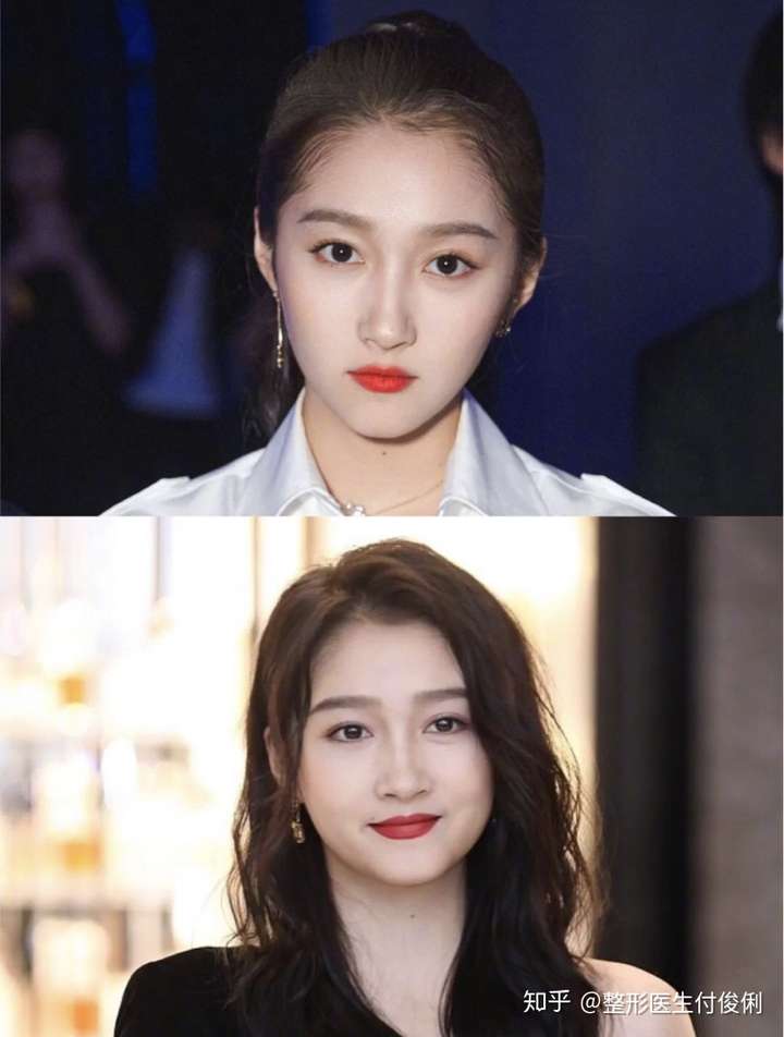 才23岁的关晓彤为什么脸这么快就发腮了