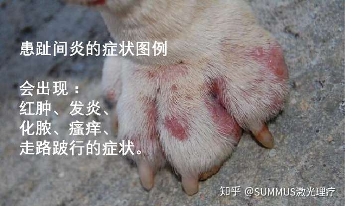 无疼痛才快乐 趾间炎又叫指尖脓皮症(足皮肤炎),经常发生在狗狗的脚趾