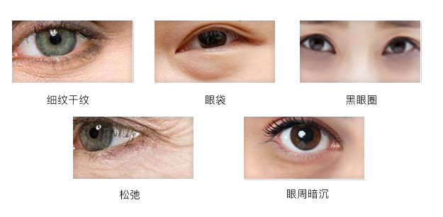 眼部肌肤诸多问题