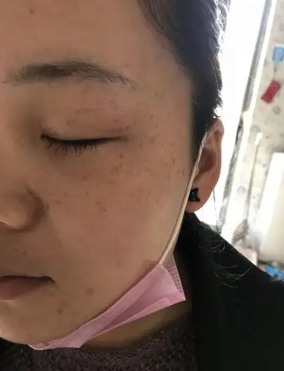 为什么别人的肌肤这么白嫰?原来是用几毛钱的它,皱纹又袪斑