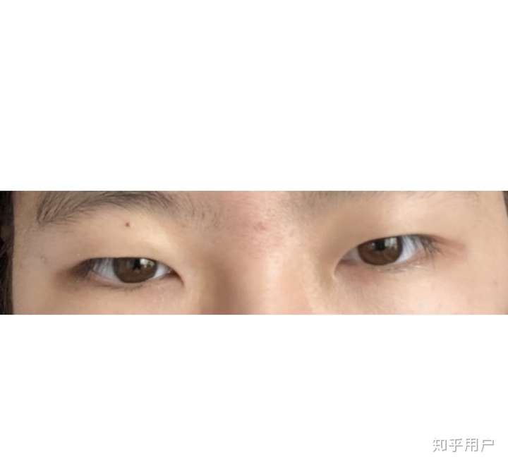 眼睛难看是什么体验?