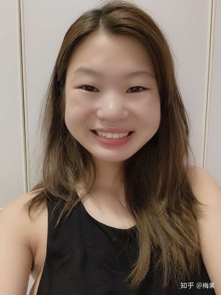 笑起来腮帮子就很鼓,不好看怎么办?