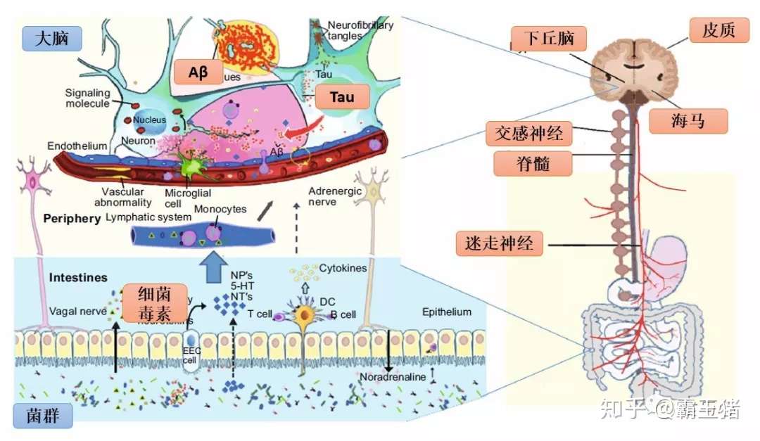 心理疾病与胃肠道 九 阿尔兹海默症与肠道微生物 知乎