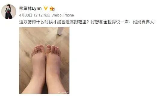 熊黛林晒照自爆产后脚肿像猪蹄产妇如何消除产后浮肿 知乎