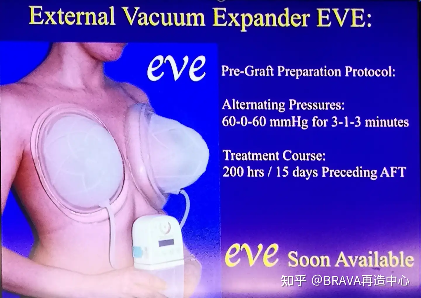 Brava アメリカFDA認可の豊胸/乳房拡張機器-