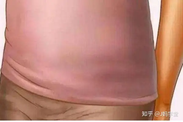 武汉助孕公司三光者日月星（宝宝怀孕全过程图片）