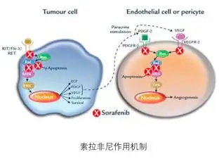 肝癌靶向治疗的耐药机制及应对措施