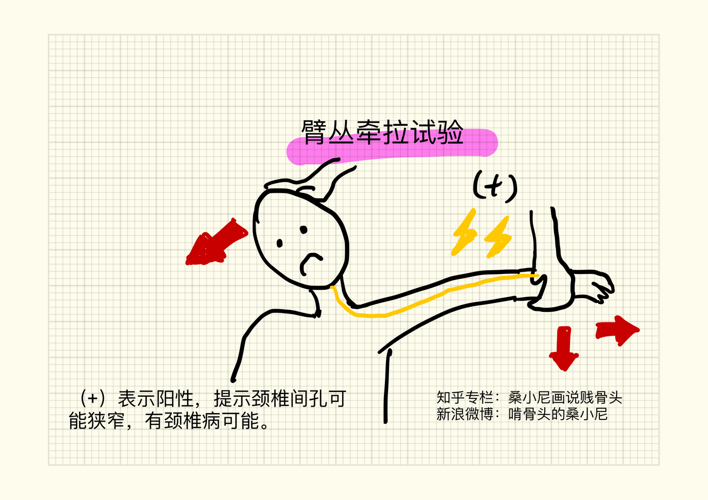 颈椎病自查小贴士 知乎