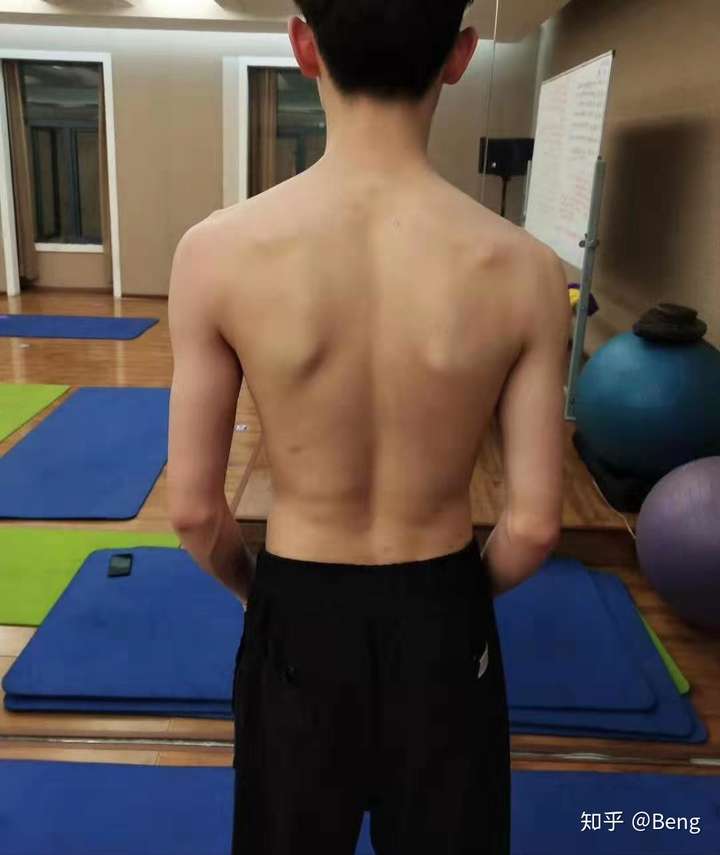 本人17岁,马上读大学,长相一般,听说健身可以提升气质,这是真的吗?