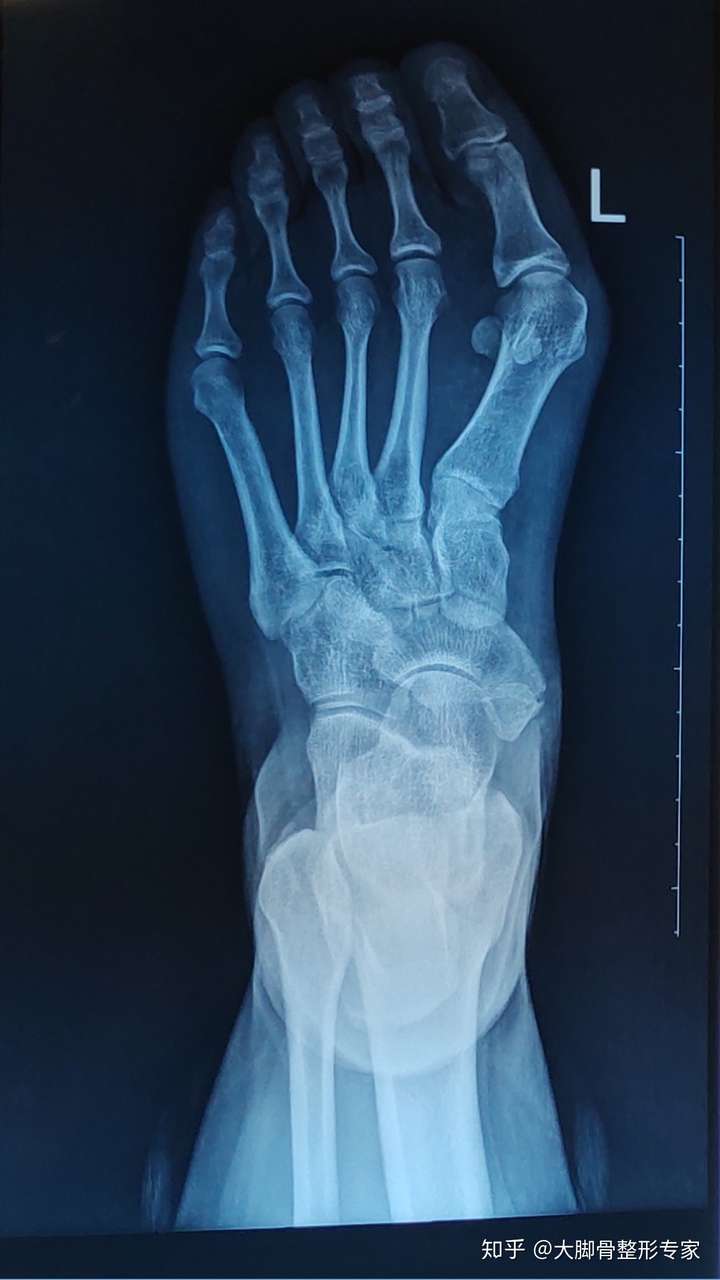 (有脚的图,慎入)?