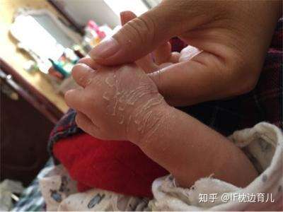 左右 差 体温