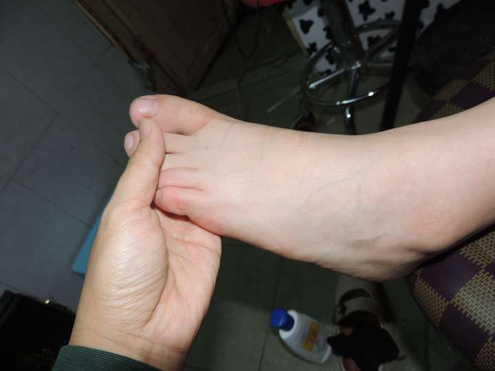 女生的大脚趾更怕痒还是其他脚趾更怕痒?