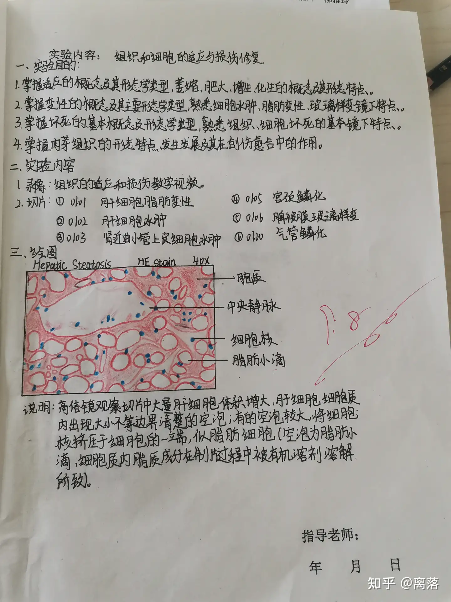 病理红蓝铅笔绘图—肝细胞水肿- 知乎