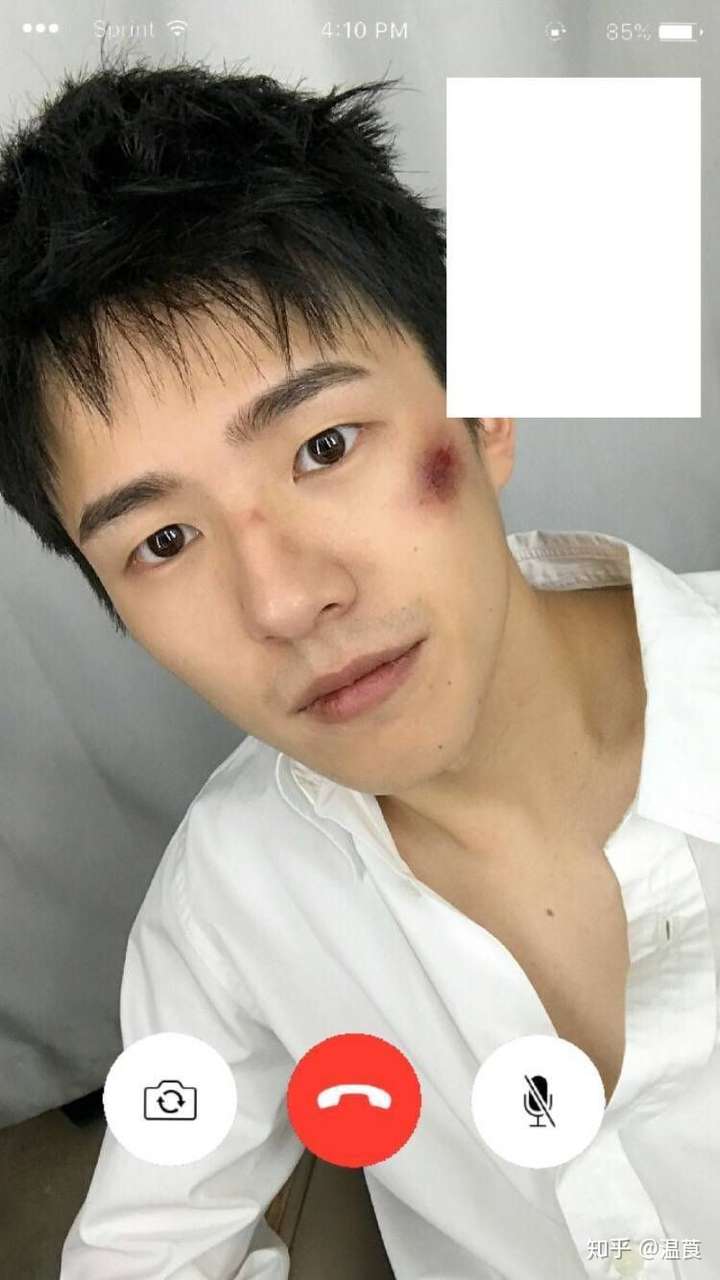 求刘昊然受伤图?