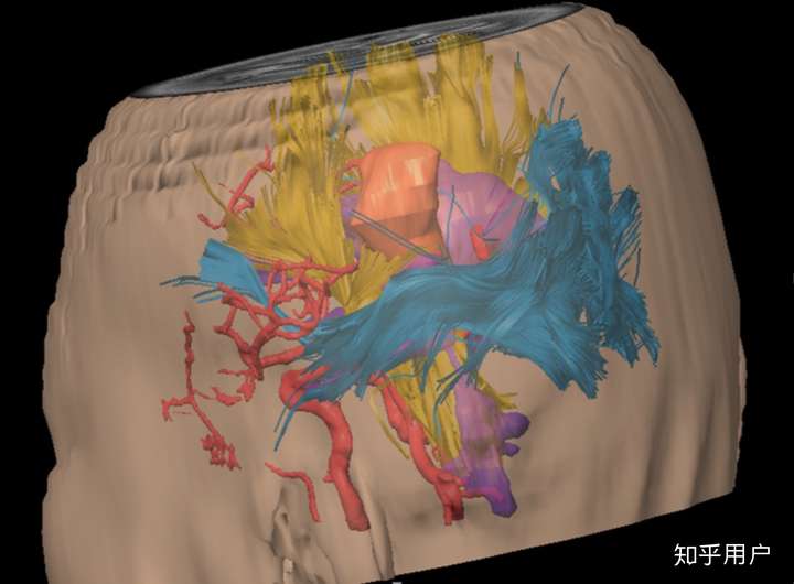 在医学图像领域,多模态融合(multimodal fusion)的研究实例有哪些?