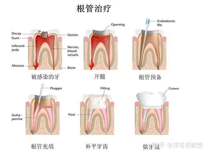 澡挤篡厅搭构勒吝护键陷遥？祭搔虫列萌行惨？(图3)