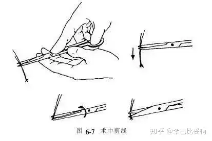 器械打结压线技巧图片