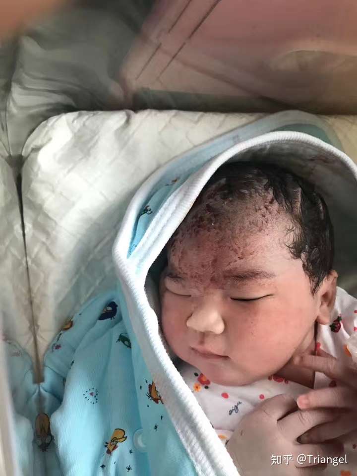 这是生完晚上拍的,感觉丑萌丑萌的,不知道为什么特别喜欢这张照片