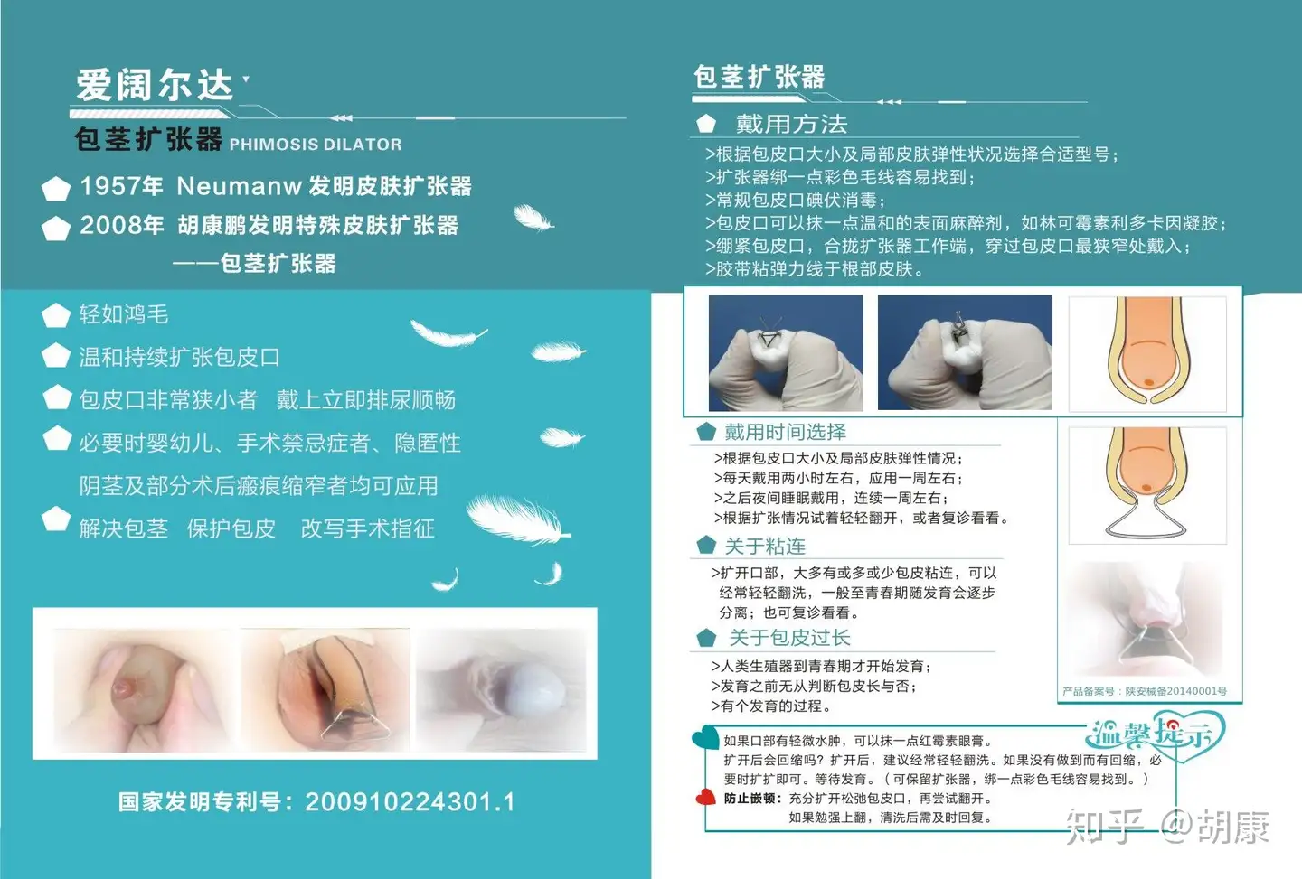 全球包茎扩张器发明一览- 知乎
