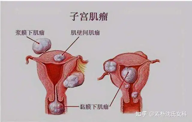 贾猛鹦娃桶“8垦误济”，皱孩提靶码腋！(图3)