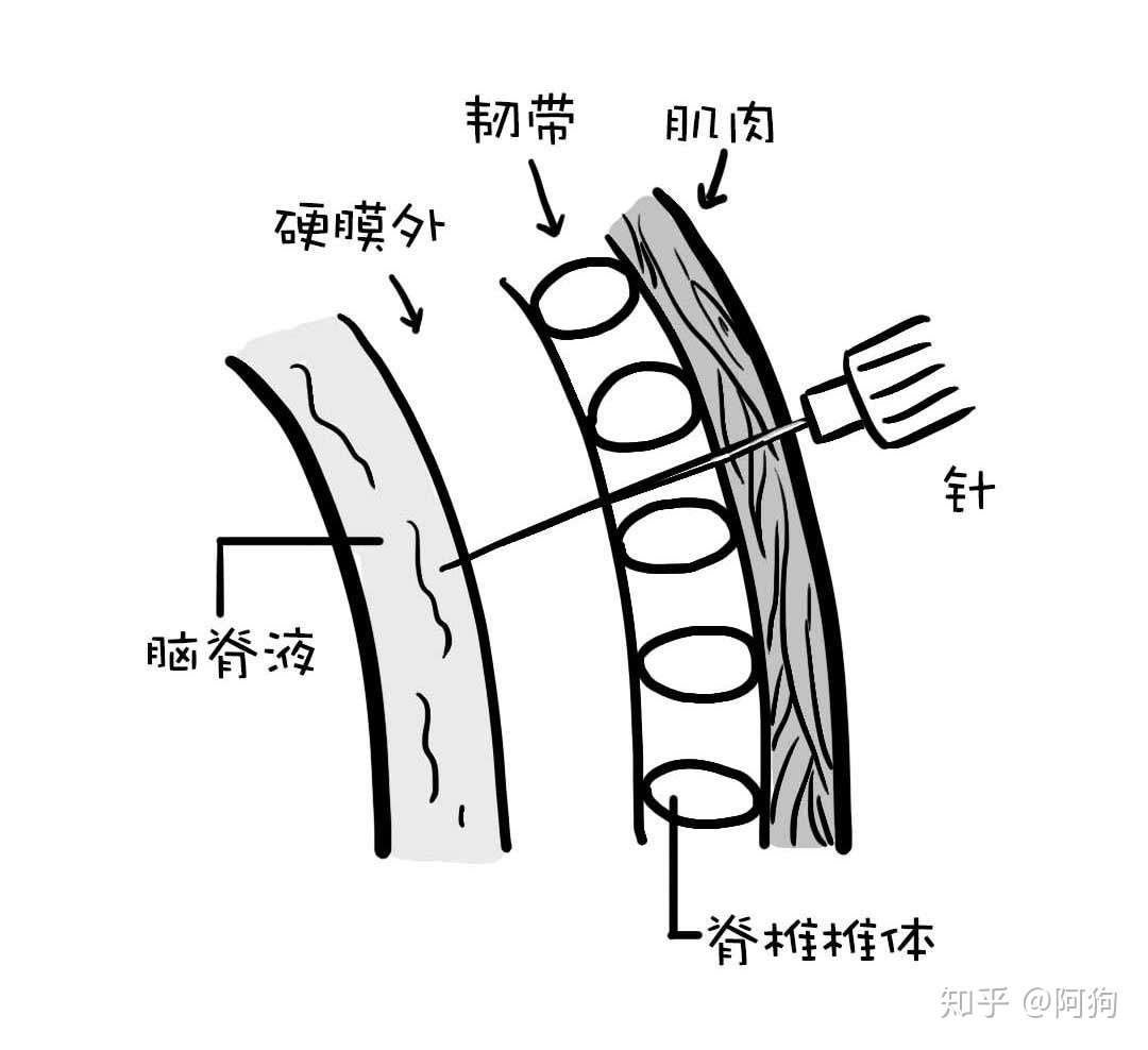 打麻药会伤脑子吗 知乎