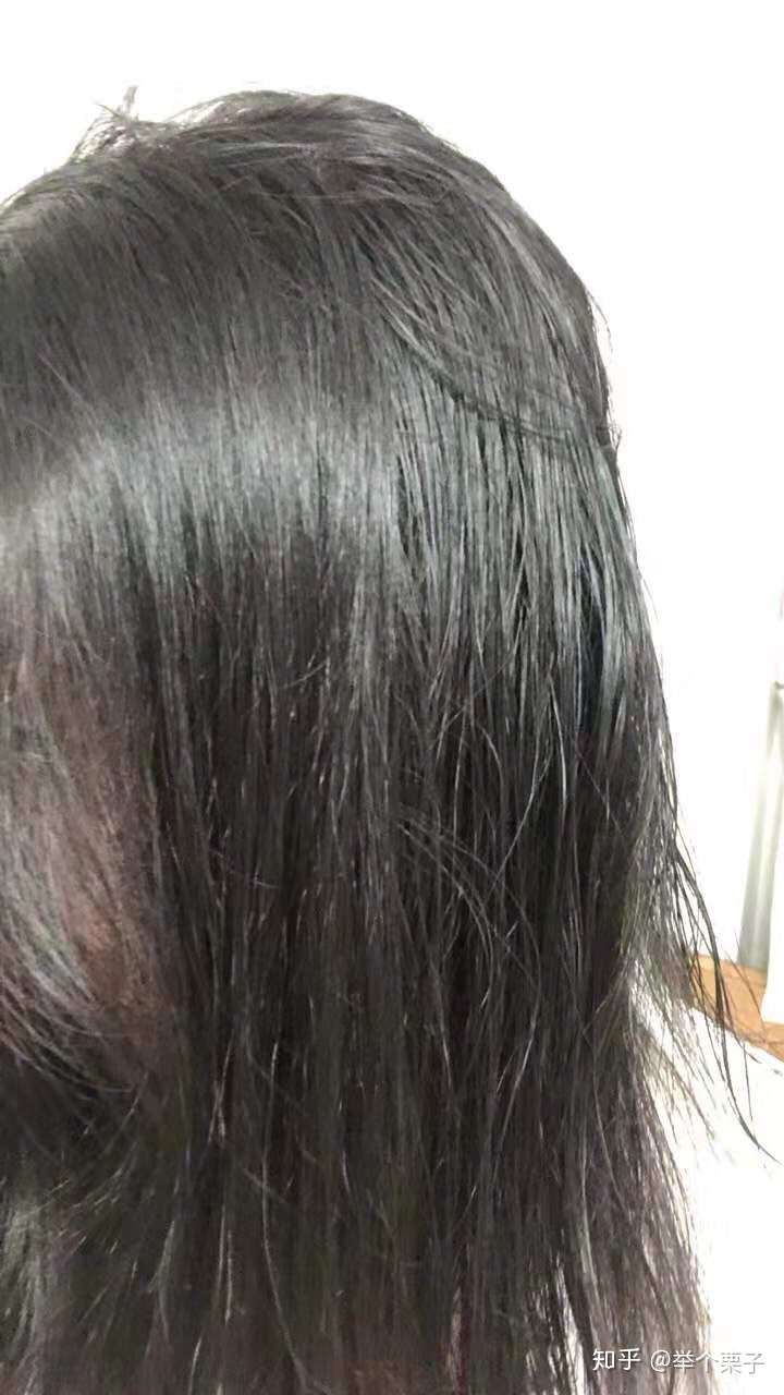 头发特别容易油有好的方法么