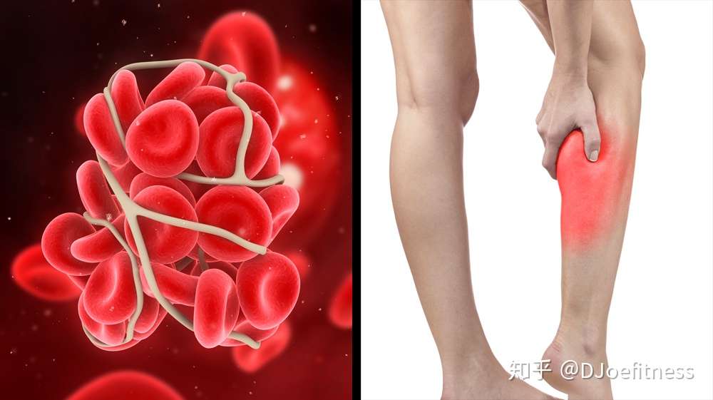 你有没有发现 你的脚踝奇怪地肿起来 告诉你8个原因 知乎