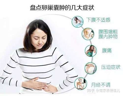 发现卵巢囊肿怎么办不要害怕知道这些就够了