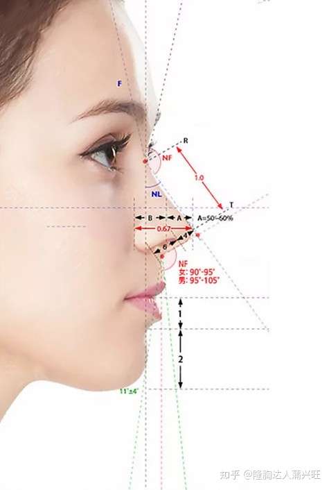 这种鼻子整形费用大约多少?
