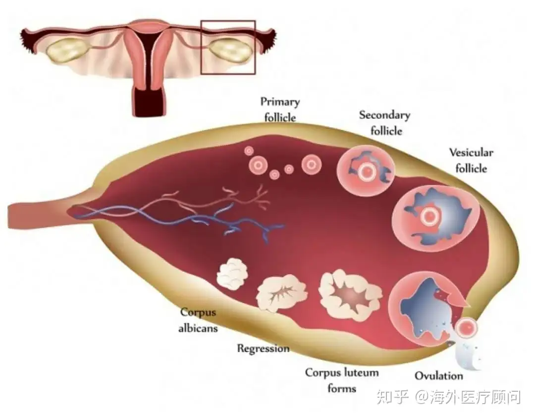 女性健康知识科普什么是黄体破裂 知乎
