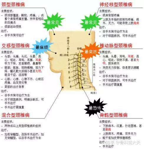 颈椎突出真的有传说中那么难治吗 它有哪些症状 知乎