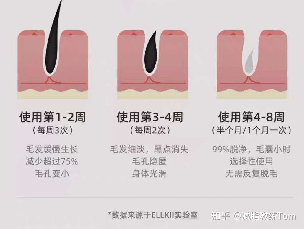 一篇文章告诉你 家用脱毛仪到底是不是智商税 最全脱毛仪避坑指南 8月已更新 知乎