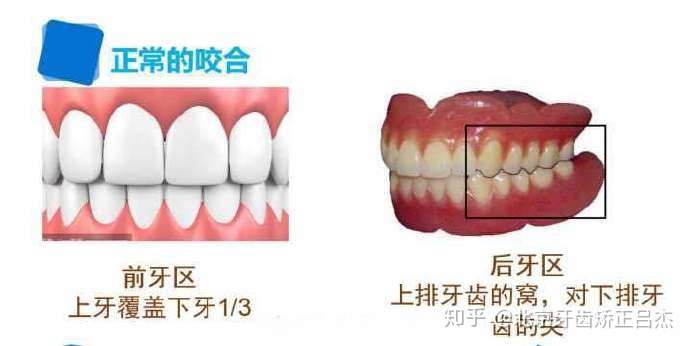 正常牙齿咬合是怎样的?