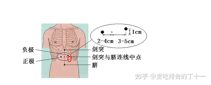 太疯狂了（成都无痛胃镜价钱）成都无痛胃镜贵吗，(图1)