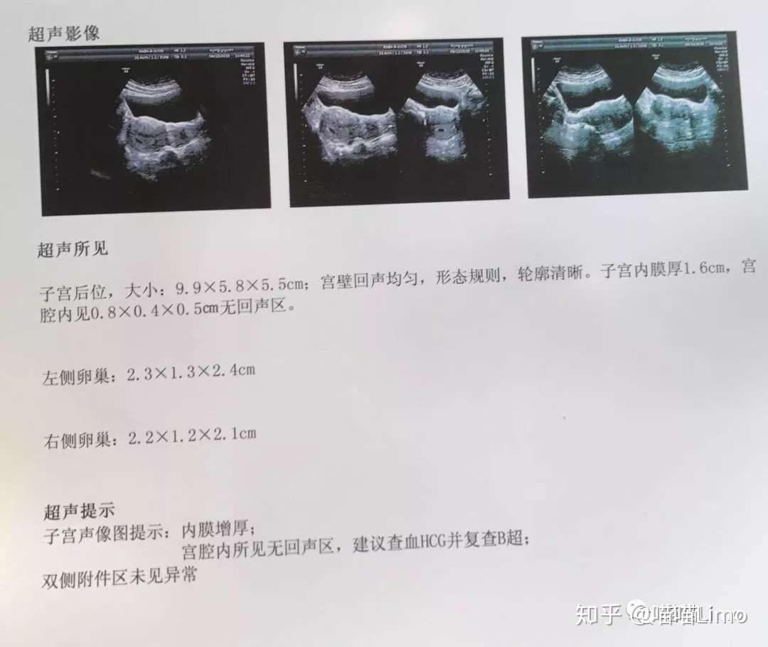 医生说 要是下周还看不见胎心胎芽 就给我开人流单子 知乎