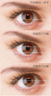 拥有一双好看的双眼皮的因素有哪些 知乎