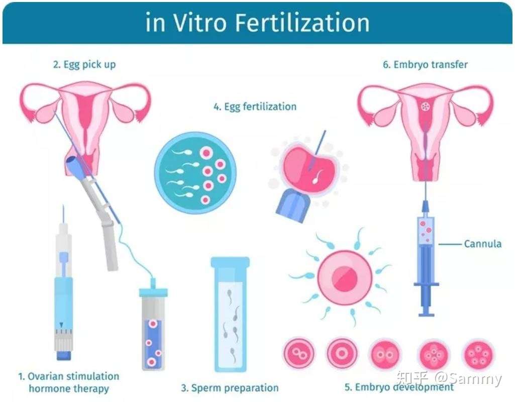 试管婴儿iui和ivf 我们该怎么选择 知乎