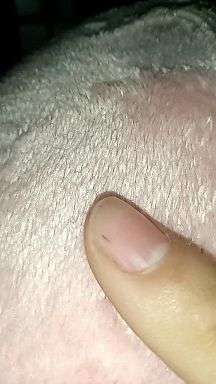 兄弟们,我这手指甲里是长刺了吗?