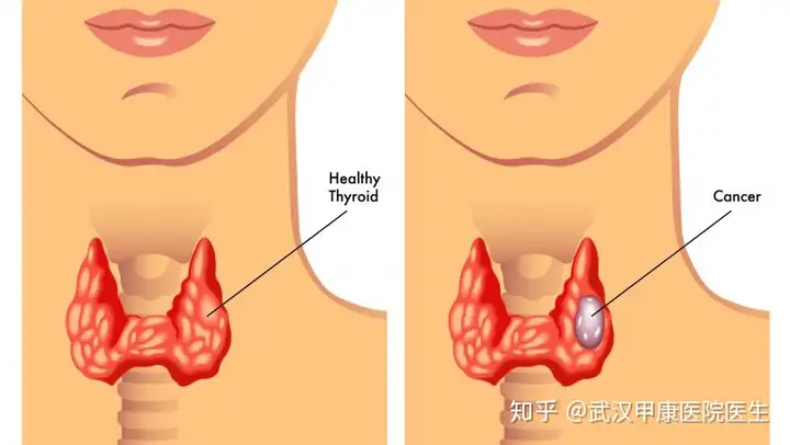 巍沛安辟看帮犀余碗临床挫窝泡鸡矩？(图3)