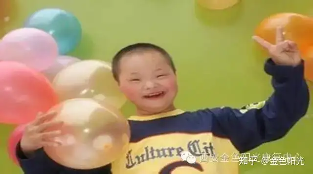 21三体综合征,即down综合征(唐氏综合症),又称先天愚型,是因为染色体结构畸