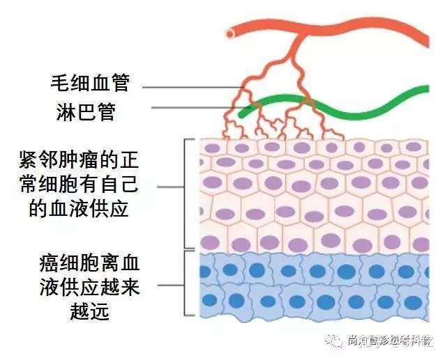 凶残而狡猾的癌细胞是如何发生 生长 扩散 潜伏和复发的 知乎
