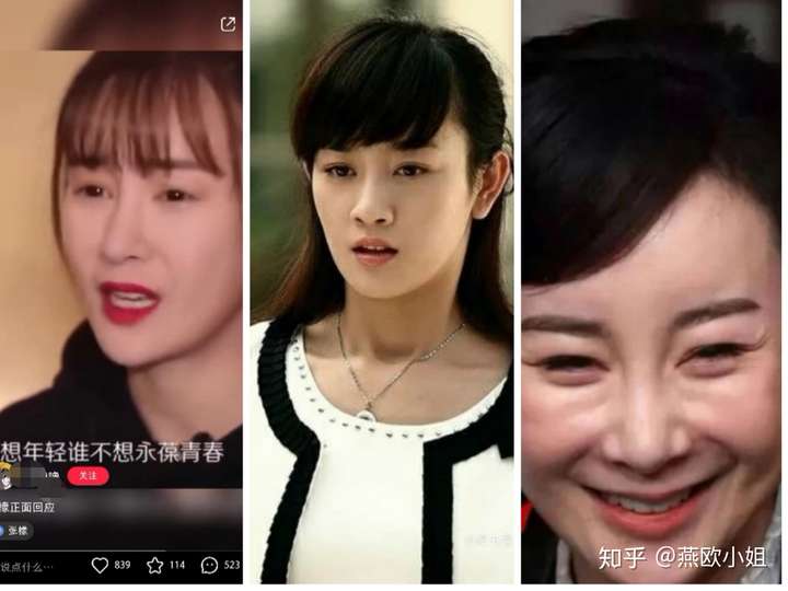 整容是可逆的吗?
