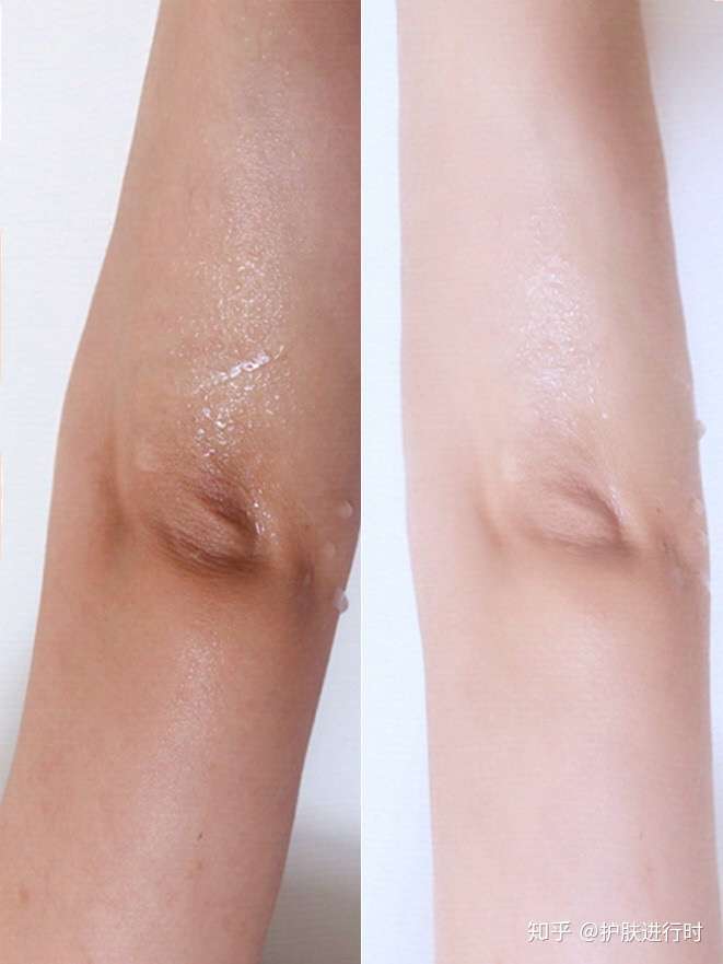 手肘皮肤黑黑的皱皱的,看到别的姑娘的肘关节白白的好羡慕啊.