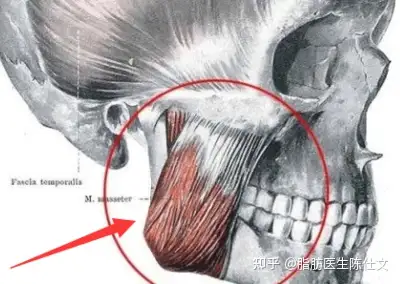 咬肌间隙图片