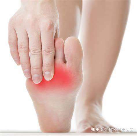 莫顿神经瘤究竟是什么鬼